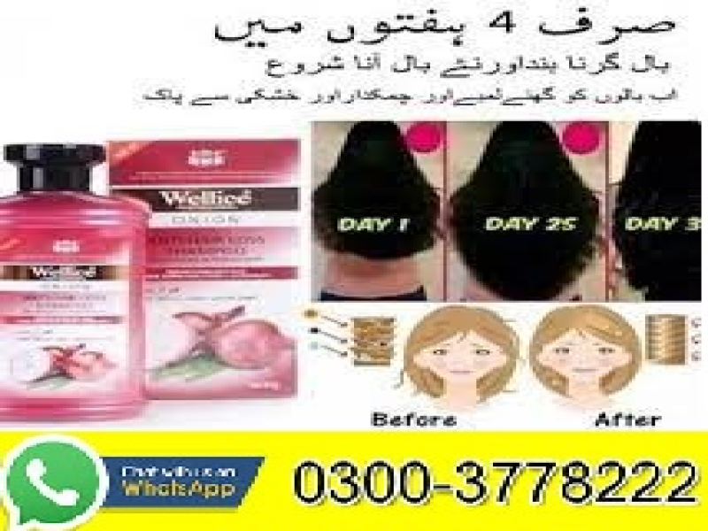 Anti Hair Loss onion Shampoo Price In Pakistan - 03003778222