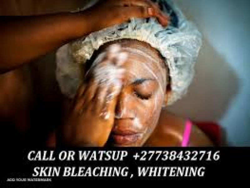 Permanent Skin Lightening Skin Whitening Products +27738432716